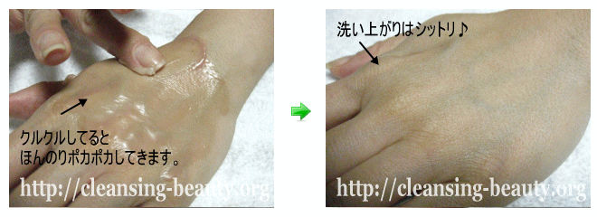 ピュールクレンジングバームをクルクルしていくとほんのりポカポカします。右の写真は洗い上がりの肌。しっとりしました。